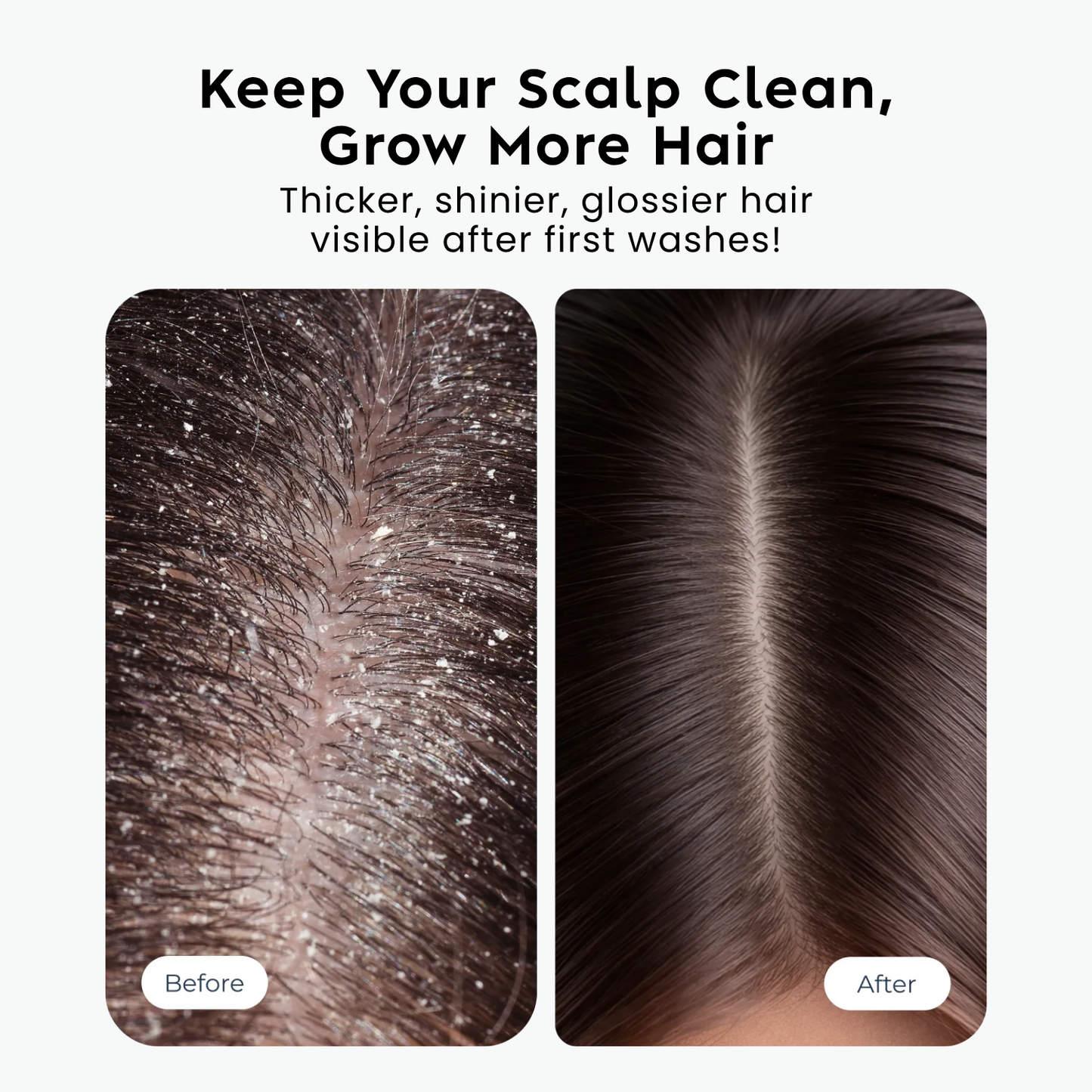 Scalp Cleansing Brush