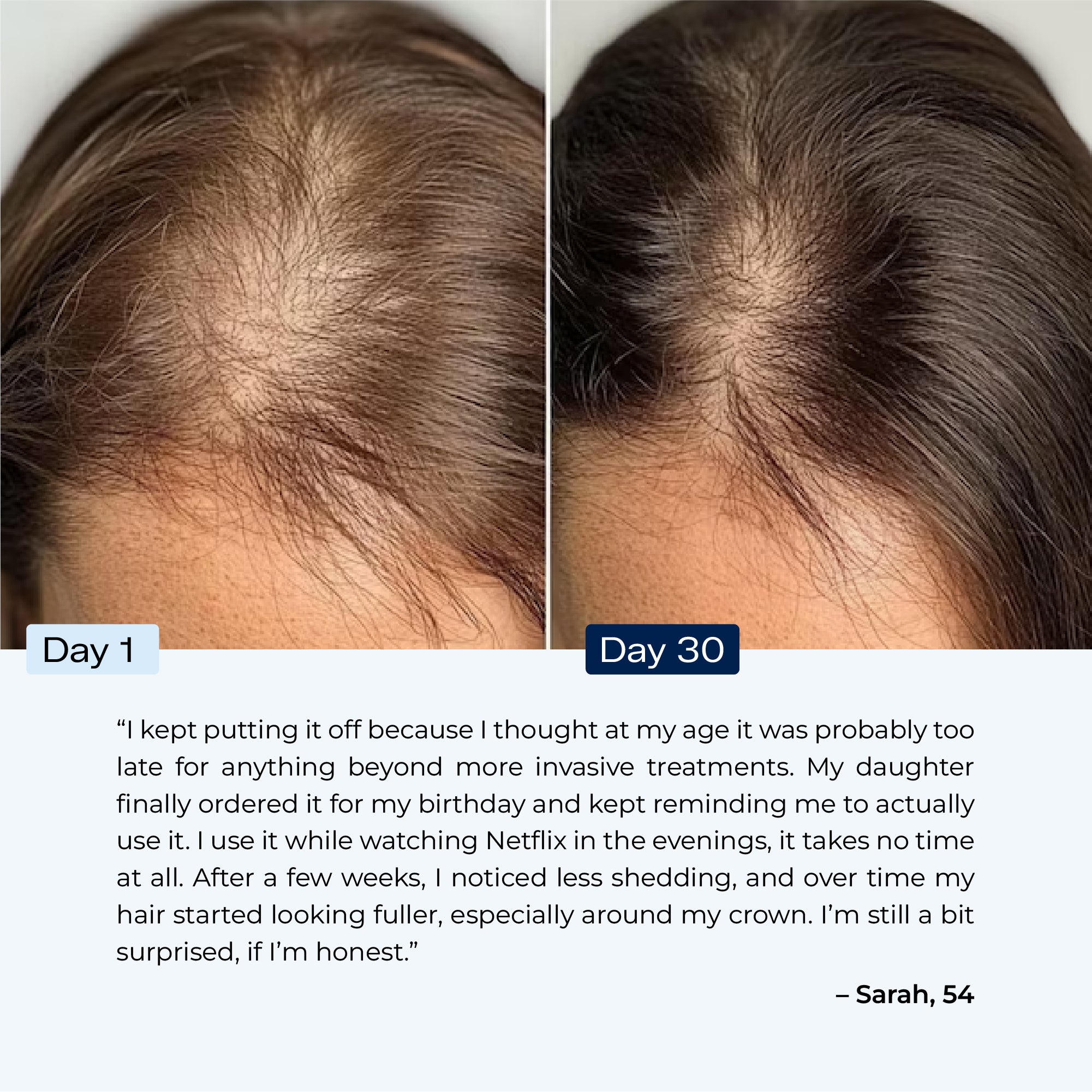 Scalpistry™ Scalp & Hair Growth Therapy Comb