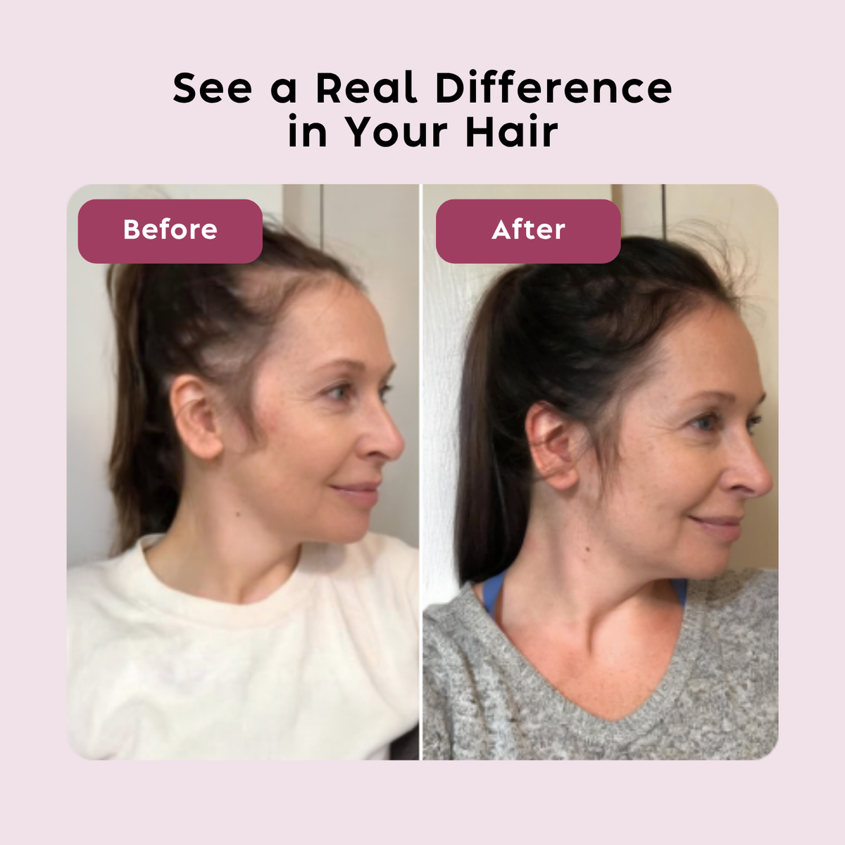 Hair Growth Serum
